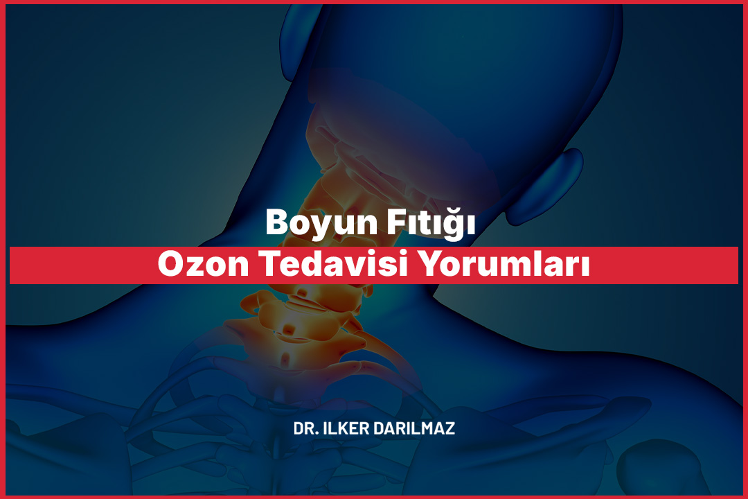 Boyun Fıtığı Ozon Tedavisi Yorumları