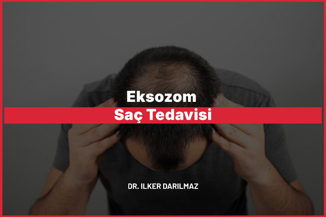 Eksozom Saç Tedavisi