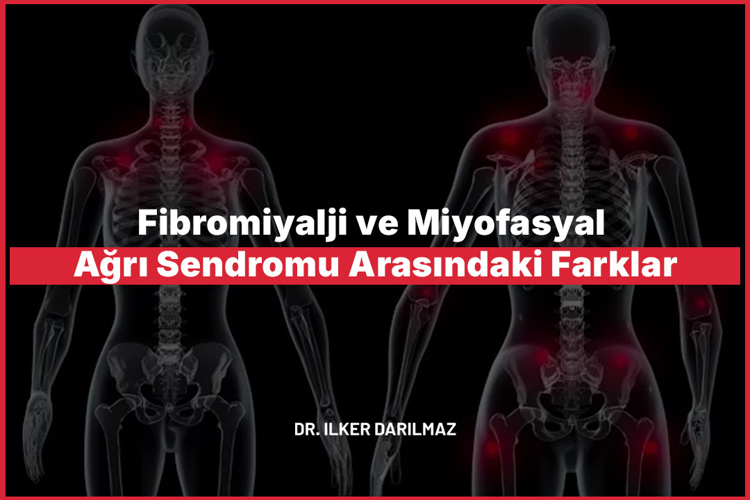Fibromiyalji ve Miyofasyal Ağrı Sendromu Arasındaki Farklar