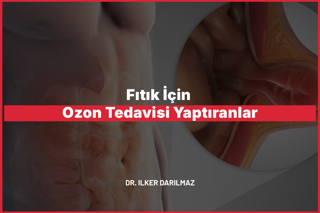 Fıtık İçin Ozon Tedavisi Yaptıranlar