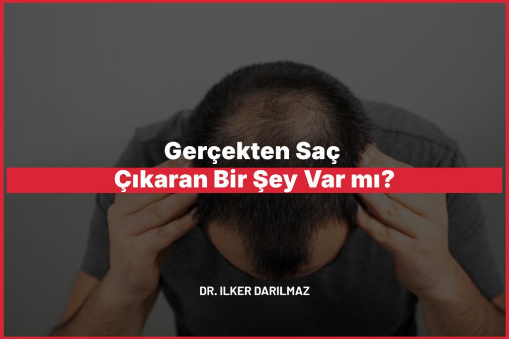 Gerçekten Saç Çıkaran Bir Şey Var mı?
