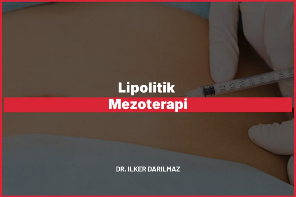 Lipolitik Mezoterapi