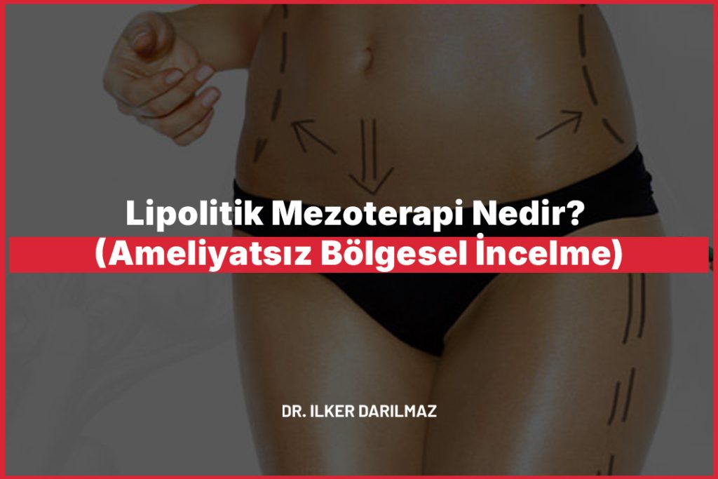 Lipolitik Mezoterapi Nedir? (Ameliyatsız Bölgesel İncelme)