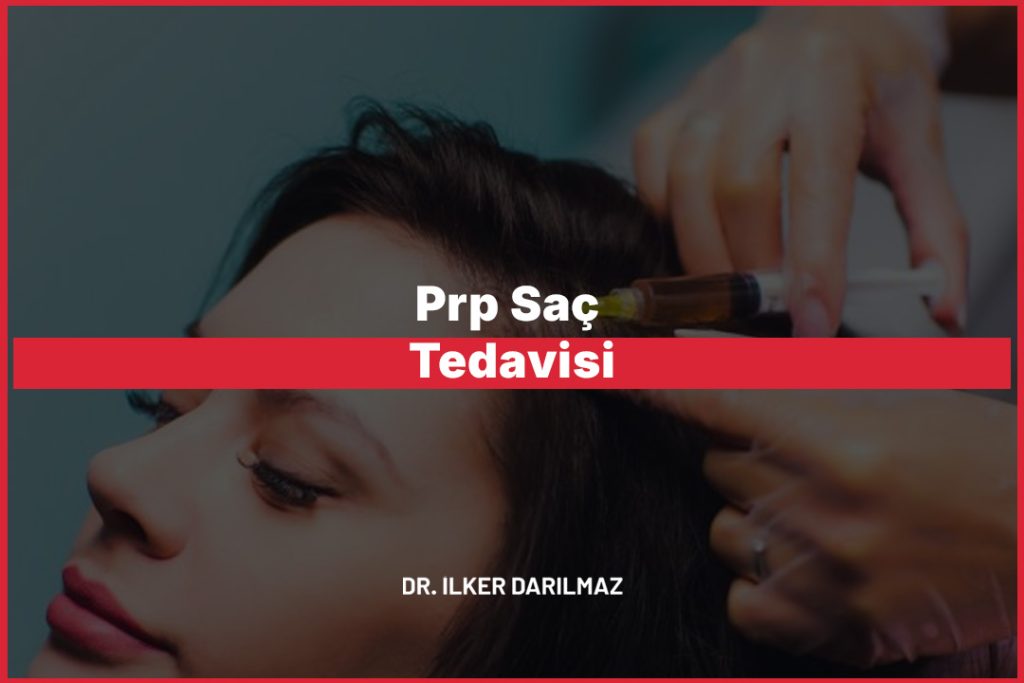 Prp Saç Tedavisi