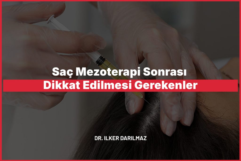 Saç Mezoterapi Sonrası Dikkat Edilmesi Gerekenler