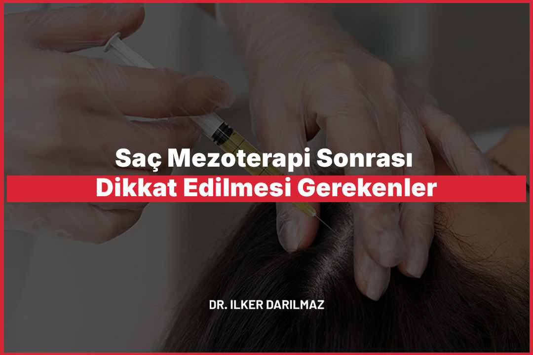 Saç Mezoterapi Sonrası Dikkat Edilmesi Gerekenler