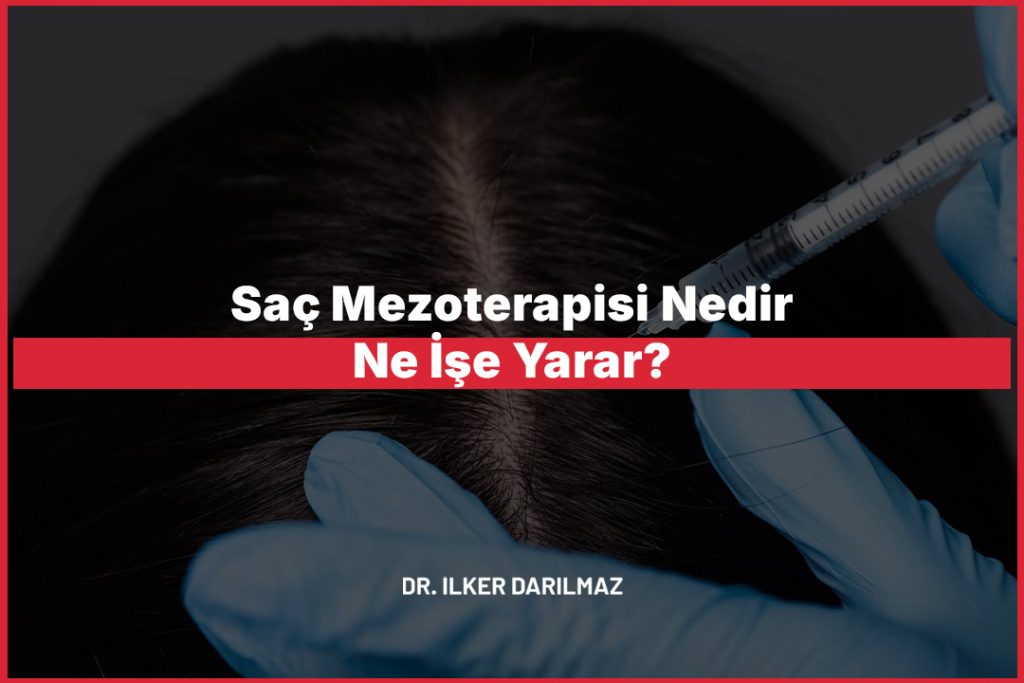 Saç Mezoterapisi Nedir, Ne İşe Yarar?