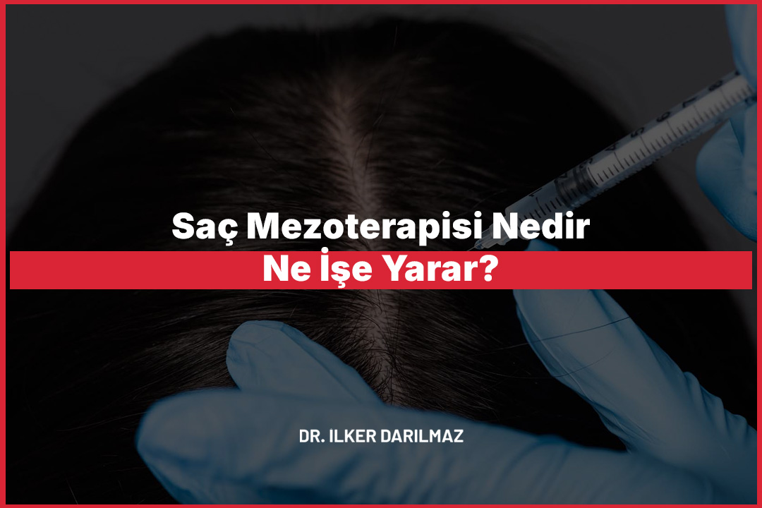 Saç Mezoterapisi Nedir, Ne İşe Yarar?