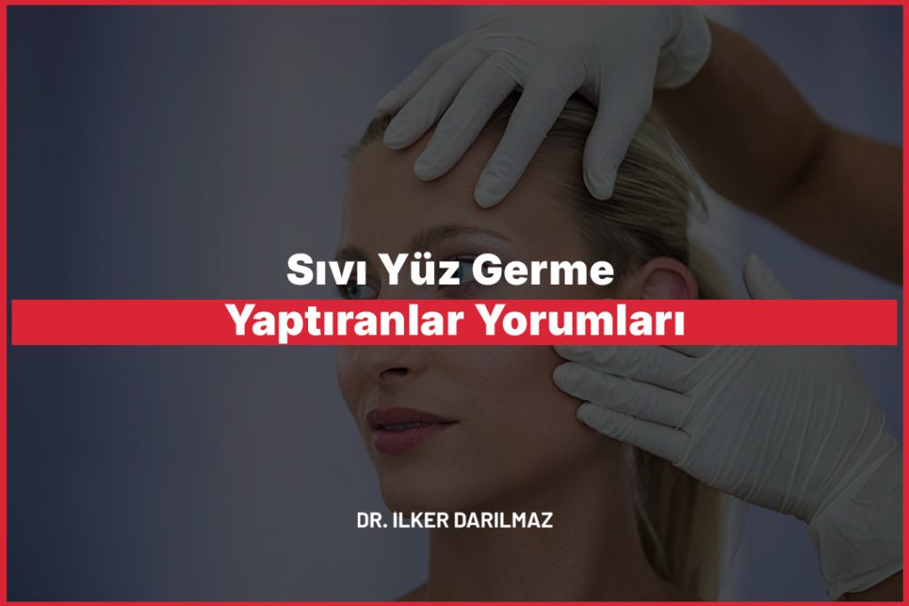 Sıvı Yüz Germe Yaptıranlar Yorumları