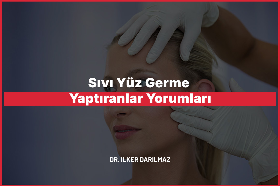Sıvı Yüz Germe Yaptıranlar Yorumları
