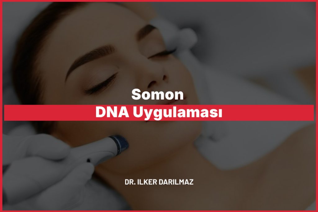 Somon DNA Uygulaması