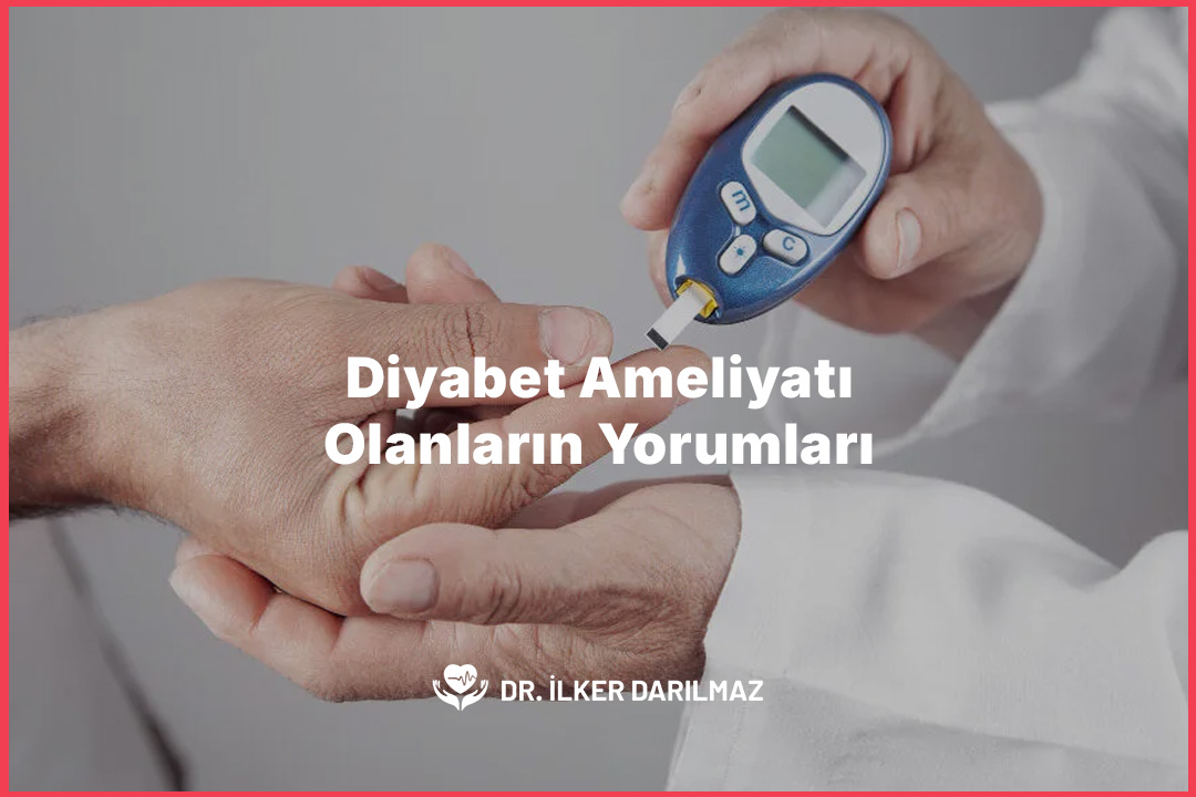 Diyabet Ameliyatı Olanların Yorumları
