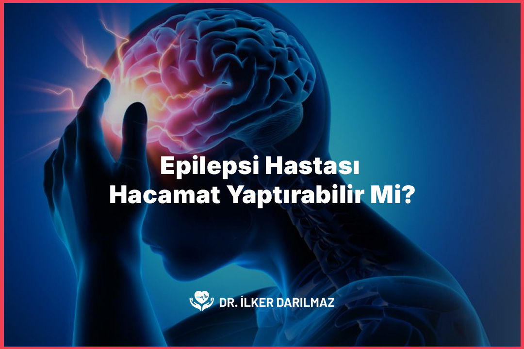 Epilepsi Hastası Hacamat Yaptırabilir Mi?