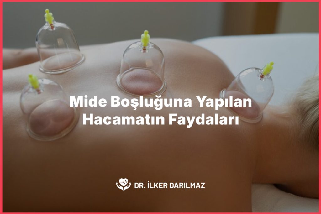 Mide Boşluğuna Yapılan Hacamatın Faydaları