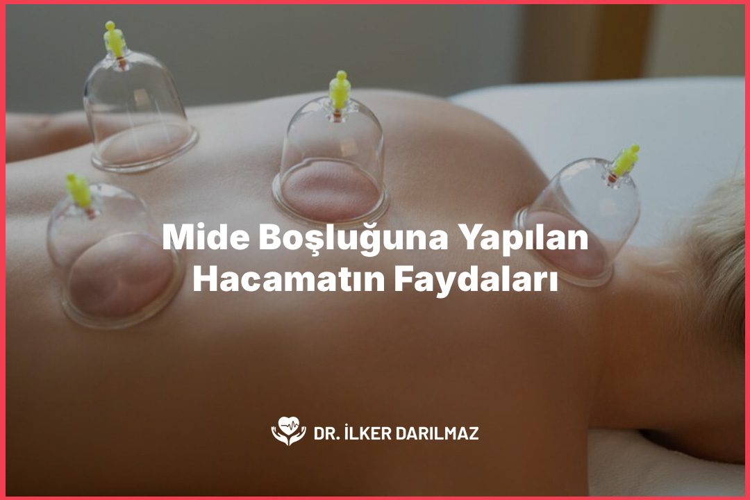 Mide Boşluğuna Yapılan Hacamatın Faydaları