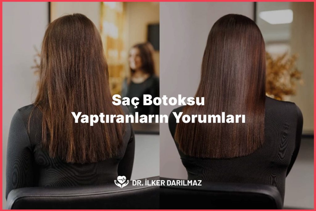 Saç Botoksu Yaptıranların Yorumları