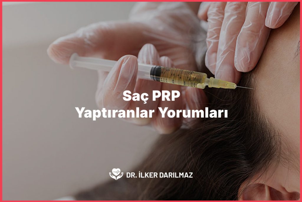 Saç PRP Yaptıranlar Yorumları