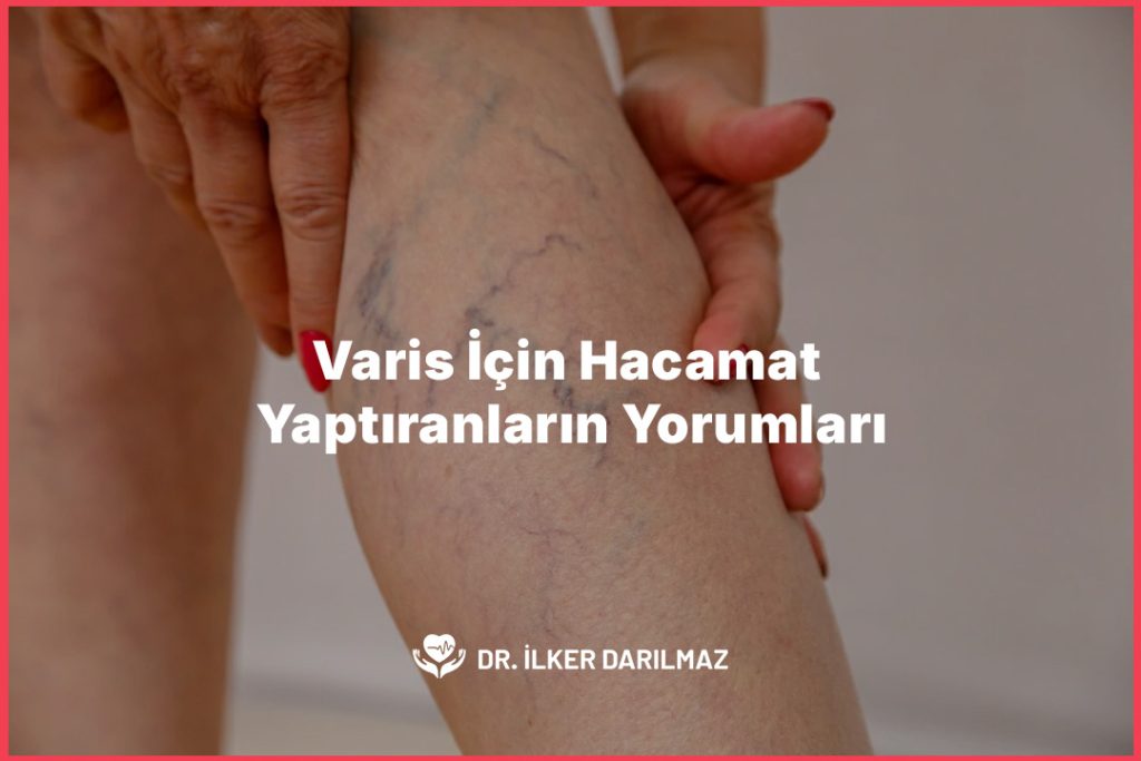 Varis İçin Hacamat Yaptıranların Yorumları