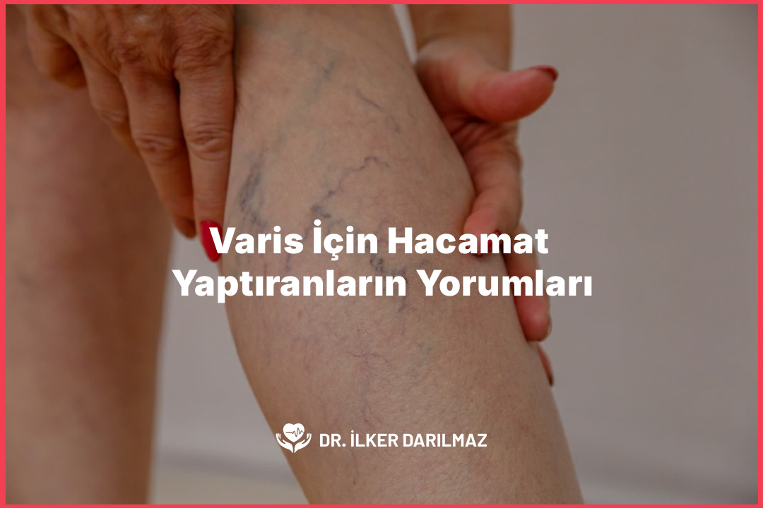 Varis İçin Hacamat Yaptıranların Yorumları