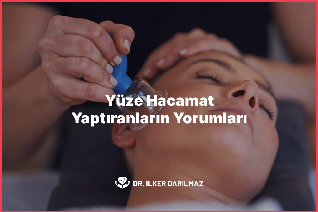 Yüze Hacamat Yaptıranların Yorumları