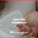 Aşırı Saç Dökülmesi