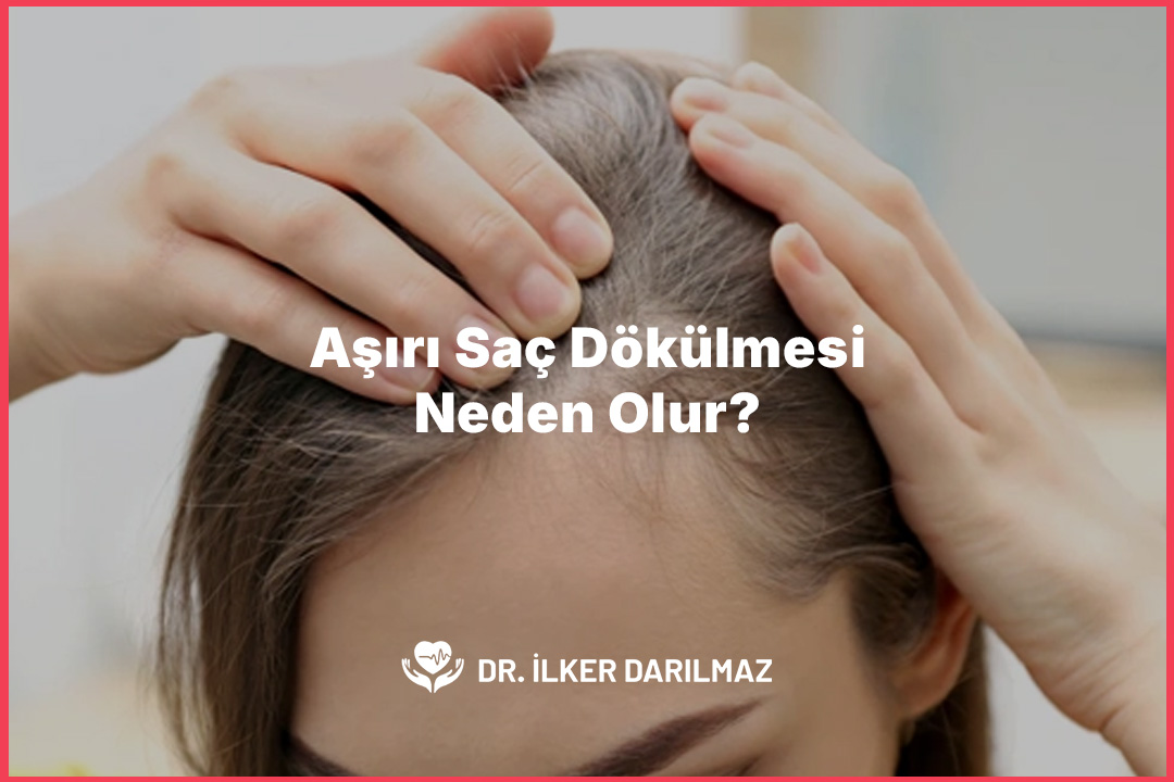 Aşırı Saç Dökülmesi Neden Olur?
