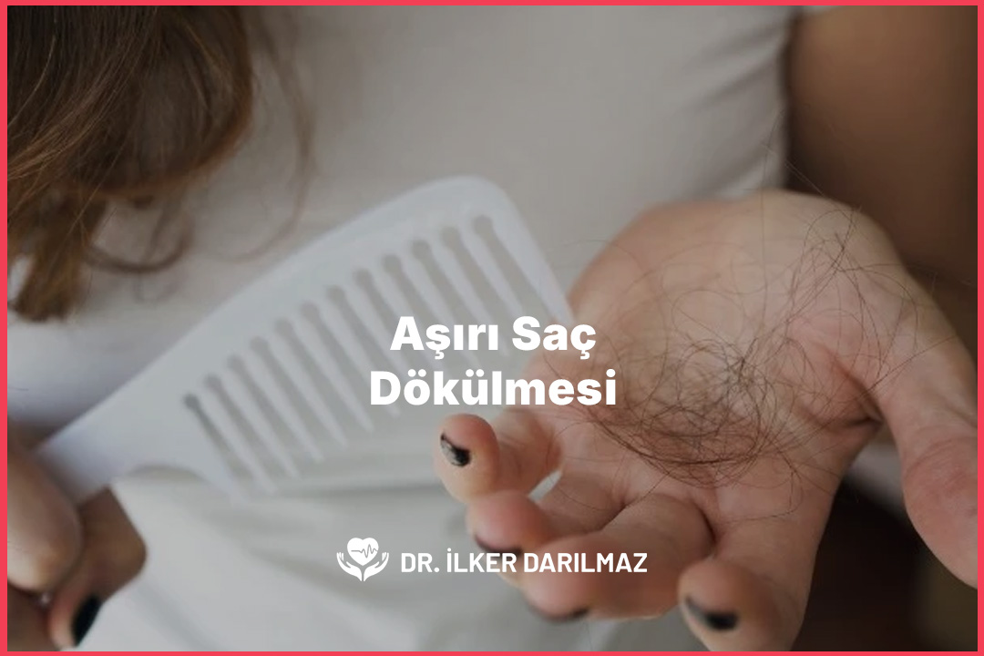Aşırı Saç Dökülmesi