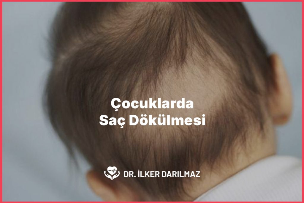 Çocuklarda Saç Dökülmesi