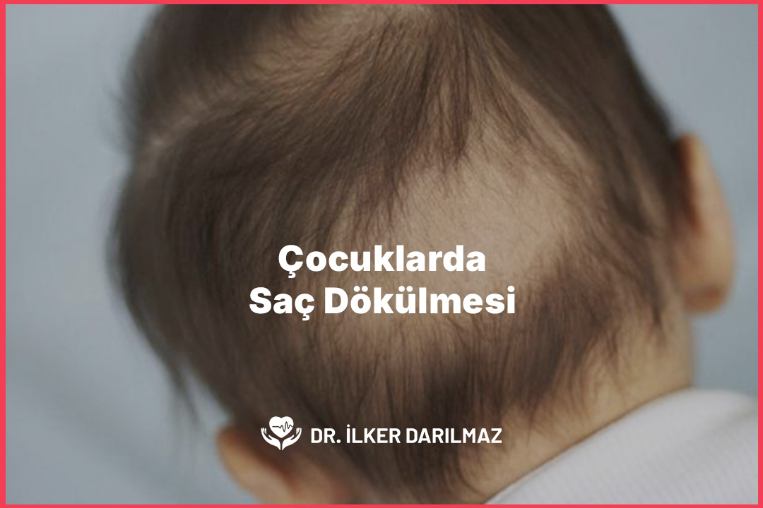Çocuklarda Saç Dökülmesi