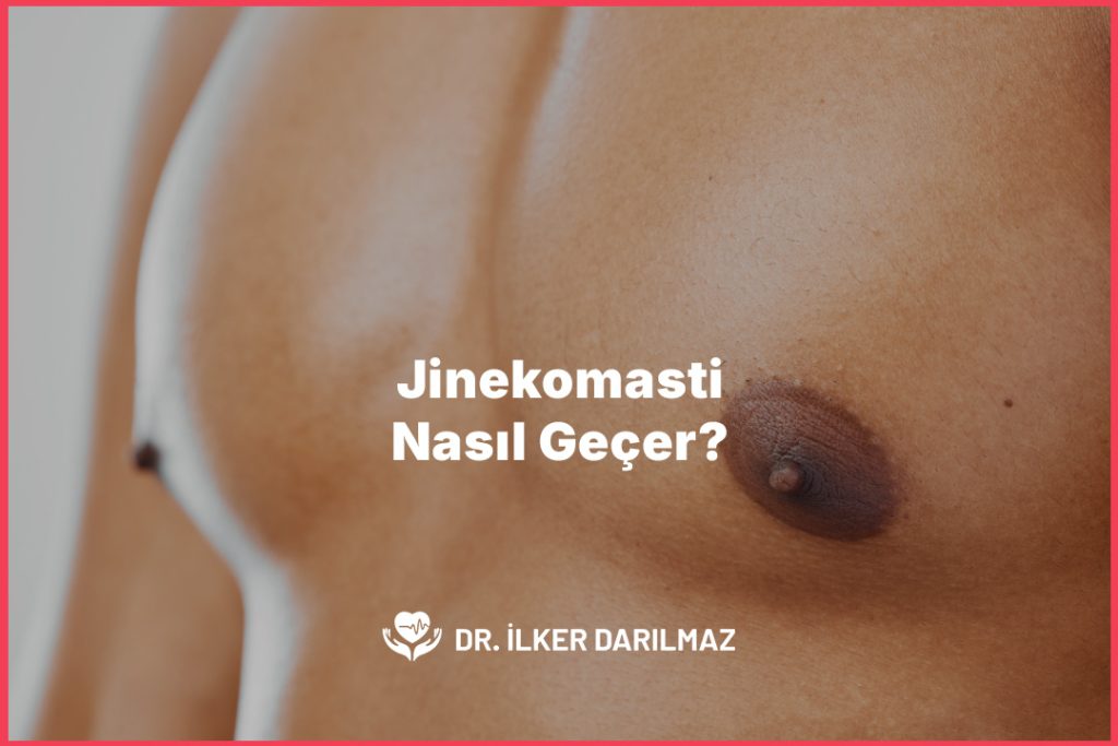 Jinekomasti Nasıl Geçer?