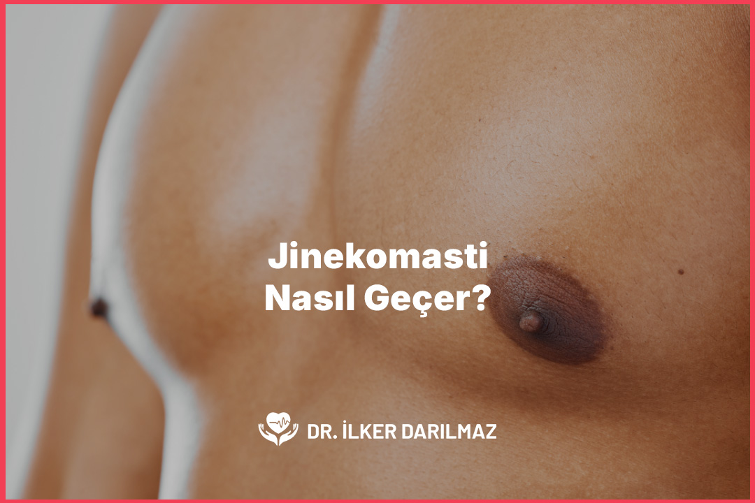 Jinekomasti Nasıl Geçer?