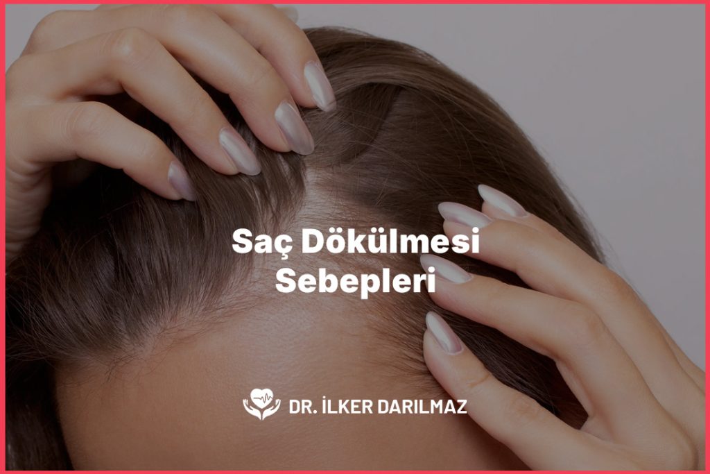 Saç Dökülmesi Sebepleri