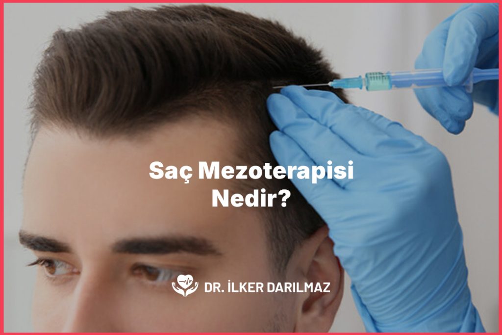 Saç Mezoterapisi Nedir?