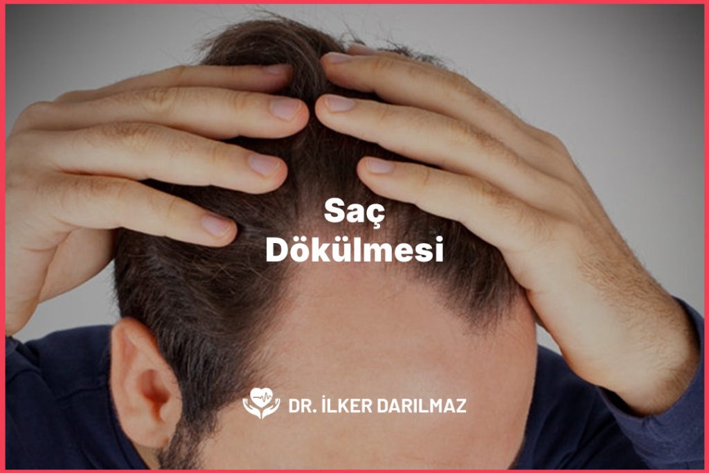Saç Dökülmesi